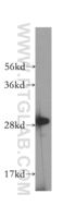 Anti-RAB10 Rabbit Polyclonal Antibody