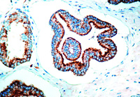 Anti-P504S Rabbit Polyclonal Antibody