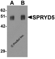 Anti-SPRYD5 Rabbit Polyclonal Antibody