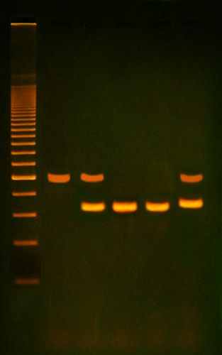 PCR BASED ALU-HUMAN DNA TYPING