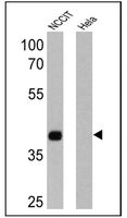 Anti-NANOG Mouse Monoclonal Antibody (HRP (Horseradish Peroxidase)) [clone: 23D2-3C6]