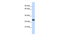Anti-KIF25 Rabbit Polyclonal Antibody