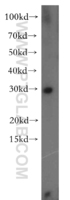 Anti-CBR4 Rabbit Polyclonal Antibody
