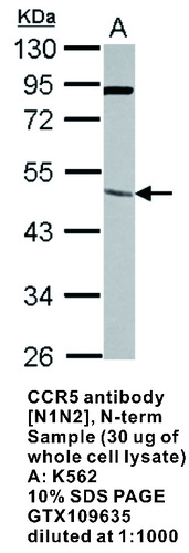 Rabbit Polyclonal antibody to CCR5 (chemokine (C-C motif) receptor 5)