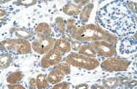 Anti-FOXP2 Rabbit Polyclonal Antibody