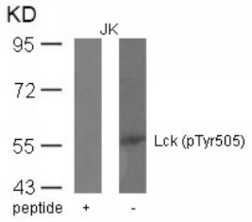 Lck (phospho Tyr505) Antibody