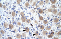 Anti-OR13C9 Rabbit Polyclonal Antibody
