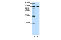 Anti-TRIM16 Rabbit Polyclonal Antibody