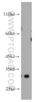 Anti-DKK1 Rabbit Polyclonal Antibody