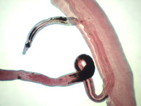 Schistosoma japonicum, Male/Female Slide