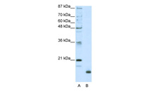 Anti-RPL32 Rabbit Polyclonal Antibody