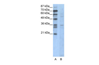 Anti-CCNB3 Rabbit Polyclonal Antibody