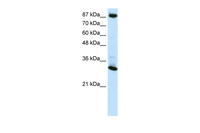 Anti-CTCF Rabbit Polyclonal Antibody
