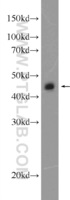 Anti-CEP44 Rabbit Polyclonal Antibody