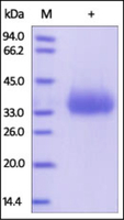Human Recombinant Srbc (from HEK293 Cells)