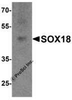Anti-SOX18 Rabbit Polyclonal Antibody