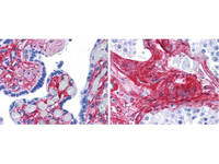 Anti-COL6A1 Rabbit Polyclonal Antibody (HRP)
