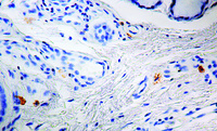 Anti-ITGB3 Mouse Monoclonal Antibody [clone: Y2/51]