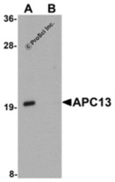 Anti-ANAPC13 Rabbit Polyclonal Antibody