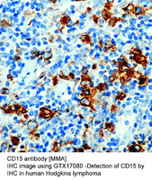 Anti-CD15 Mouse Monoclonal Antibody [clone: MMA]