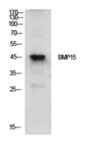 ANTIBODY ANTI-BMP15 100UG