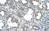 Anti-SLC26A5 Rabbit Polyclonal Antibody