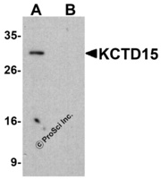 Anti-KCTD15 Rabbit Polyclonal Antibody