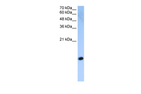 Anti-HIST2H2AC Rabbit Polyclonal Antibody