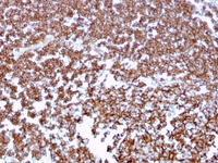 Anti-CD20 Mouse Monoclonal Antibody [clone: MS4A1/3409]