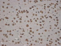 Anti-STRN4 Mouse Monoclonal Antibody [clone: S88-64]