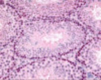 Anti-GLI2 Rabbit Polyclonal Antibody