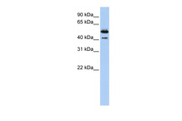 Anti-DNASE2B Rabbit Polyclonal Antibody