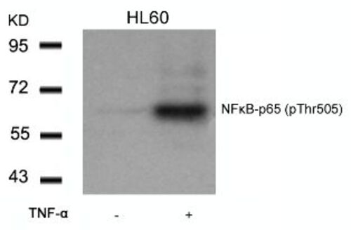 NFkB p65 (phospho Thr505) Antibody