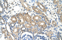 Anti-BSDC1 Rabbit Polyclonal Antibody