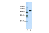 Anti-CLCNKB Rabbit Polyclonal Antibody