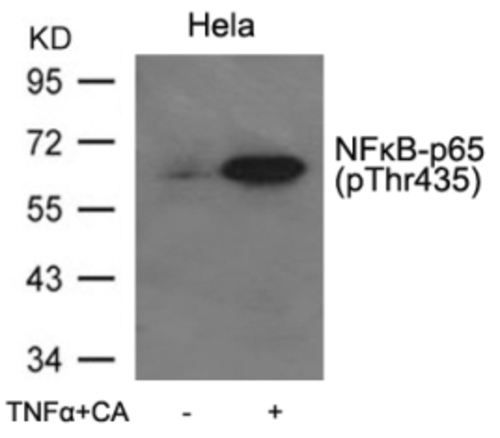 NFkB p65 (phospho Thr435) Antibody