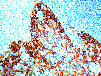 Anti-CK5 + CK6 Mouse Monoclonal Antibody [clone: D5/16 B4]