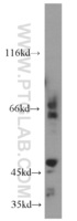 Anti-MMP14 Rabbit Polyclonal Antibody