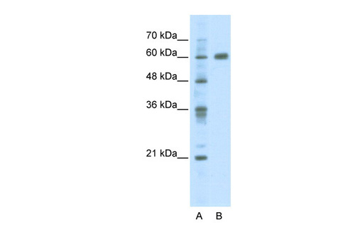 PDLIM5 Antibody