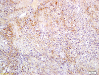 Anti-SLC27A2 Rabbit Polyclonal Antibody