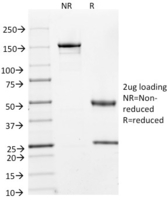Anti-Cyclin A2 Mouse Monoclonal Antibody [Clone: E67]