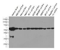 Anti-TUBA1 Mouse Monoclonal Antibody