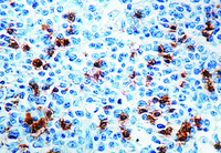 Anti-B3GAT1 Mouse Monoclonal Antibody [clone: NK-1]