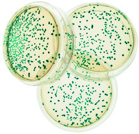 Transformation of Escherichia coli Lab, Edvotek