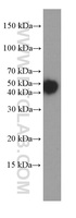 Anti-CK18 Mouse Monoclonal Antibody [clone: 1G11C4]