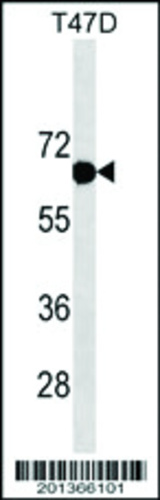 ESR1/ER(Ascites)