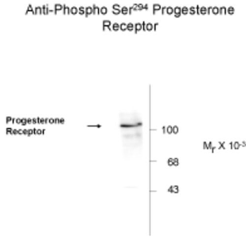 Progesterone Receptor (phospho Ser294) Antibody