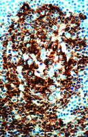 Anti-Cd20 B Cell Mouse Monoclonal Antibody [clone: L26]