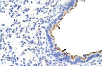 Anti-ZNF16 Rabbit Polyclonal Antibody