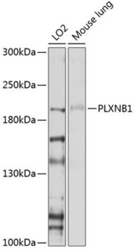Anti-Plexin B1 Rabbit Polyclonal Antibody